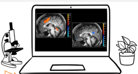 Photo de deux cerveaux: Un avec 2 aires oranges illuminées et un autre avec une aire bleue illuminée